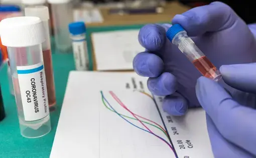 A scientist studies the curves of the Covic-19 pandemic and the DNA of an infected person, holding a sample vial in a hospital. Image by Felipe Caparros / Shutterstock. Spain, 2020.
