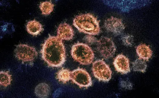 The heartburn remedy famotidine may disable a key enzyme that the new coronavirus uses to make copies (gold) of itself. Image courtesy NIH.