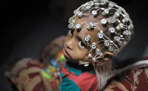 In Dhaka, a child undergoes electroencephalography to measure electrical brain activity. Image by Smita Sharma. Bangladesh.