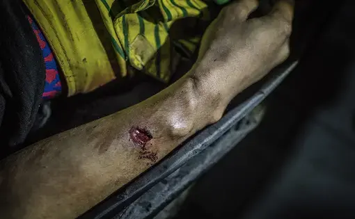 The indentation on the wrist of Julius Soriano, 24-years-old, shows signs that his hands were bound before he was shot to death during a police operation in Caloocan, Metro Manila. There is a bullet wound in his arm too, and the slug is still embedded in his arm, coming to a stop exactly were the indentation line left an impression in his skin, suggesting that whatever caused the indentation stopped the bullet too. Image by James Whitlow Delano. Philippines, 2017.