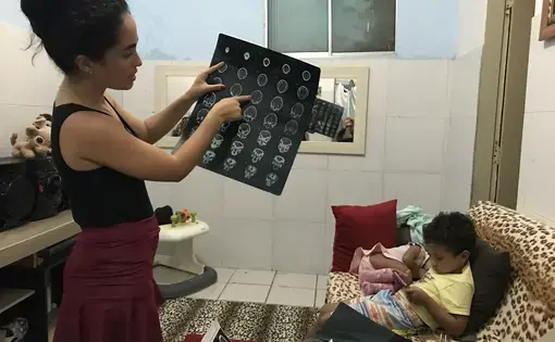 Dhulha Alen Silva do Nascimento, 25, explains a CT scan of daughter Valentina’s brain, pointing out areas of calcification and hydrocephalus. Image by Poonam Daryani. Brazil, 2017.