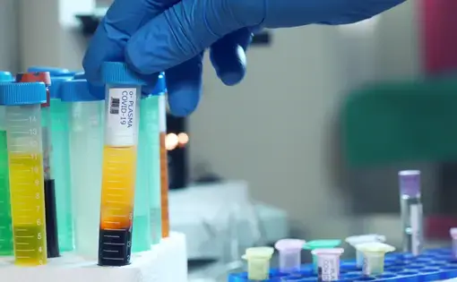 A large plastic vial containing blood plasma from a patient who has survived COVID-19. Image by JHDT Productions / Shutterstock. 2020.