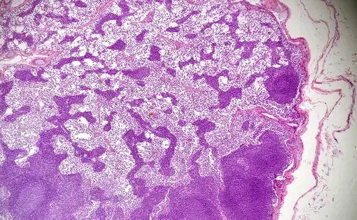 Microscopic view of a lymph node