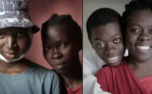 Two teenage boys in Haiti have advanced forms of cancers with high survival rates. One of them has treatment in Miami and the other is struggling to get treatment in a broken healthcare system in Haiti. Image by José A. Iglesias. Haiti, 2018.