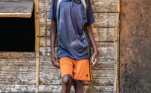 The Science Magazine cover for the award-winning story featured Stanis Malom, a 15-year old Papua boy whose leg is disfigured by yaws disease. Image by Brian Cassey. Papua New Guinea, 2018. 