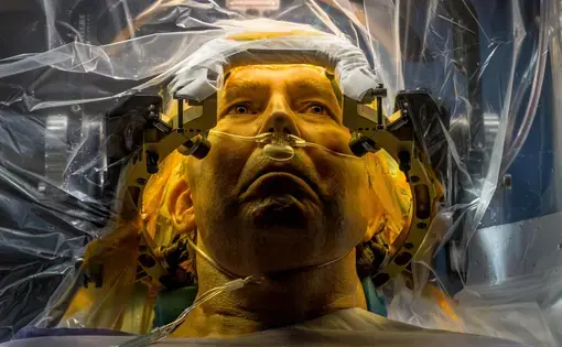 At the University of Florida, Parkinson’s disease patient Russell Price undergoes surgery to implant a deep brain stimulation (DBS) lead