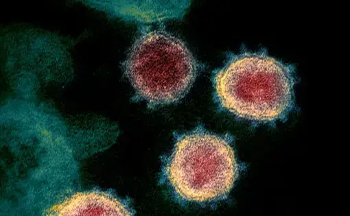 The pandemic coronavirus SARS-CoV-2 (shown above) may&nbsp;under certain conditions&nbsp;integrate its genetic material into human cells, confounding COVID-19 diagnostic tests. Image by NIAID.