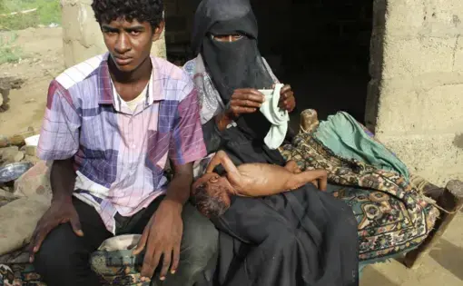 Severely malnourished infant Zahra is changed by her mother, right, in the village of al-Mashradah, Aslam, Hajjah. Image by Hammadi Issa for AP. Yemen, 2018.