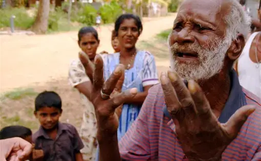 This elderly man was forced from his home two years ago and is desperate to return, Eastern Province. 1