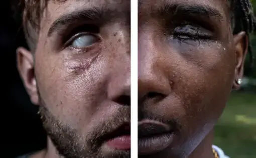 Two portraits of one half of two different men's faces arranged side by side to make a whole. On the left is a man with brown hair, a mustache and beard, and a completely white eye with no iris or pupil visible. On the right is a man with short, black twists, a mustache, and a diamond stud earring, and his eye is scarred and closed.