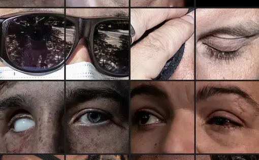 A collage of photos of eyes.