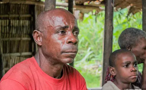 Henry Nlema, 50, sits in a wall-less common area with other members of a community in Campo covered by a thatch roof with trees in the background.