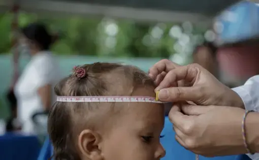 Baby getting head measured