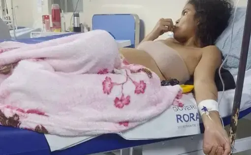 A young woman lies in a hospital bed.