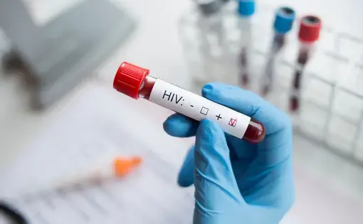 a gloved hand holds a vial of blood marked HIV+