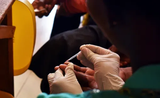 HIV treatment in Ghana health clinic