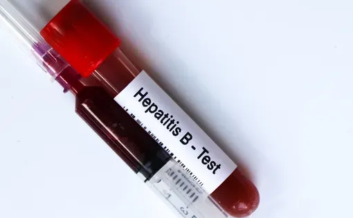 Hepatitis B test sample