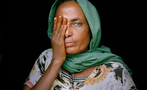 45-årige Kasech Kebede fortæller, at hun plukkede blomster hos Sher, indtil hun ved en fejl fik sprøjtemidlet i sit venstre øje og blev efter eget udsagn blind.