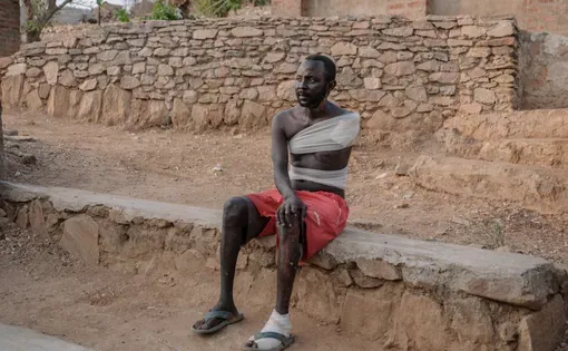Baballa Hassan sits for a portrait in a hospital near Kauda, where he is recovering from severe injuries from a drone strike, Feb. 15, 2026. (Guy Peterson)
