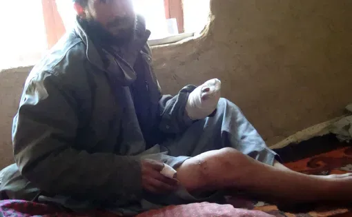 Media file: abdul-bashir-afghanistan-land-mines_10238.JPG