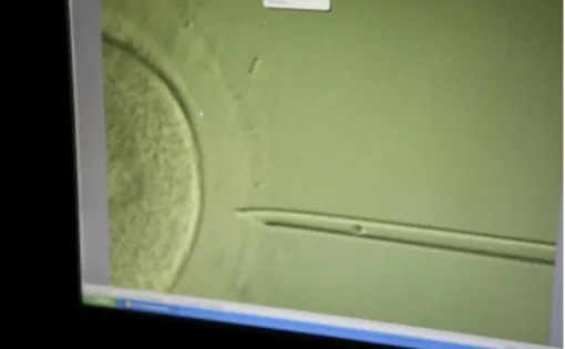 A computer screen showing the moment of conception at a the Institut Marquès in Barcelona.