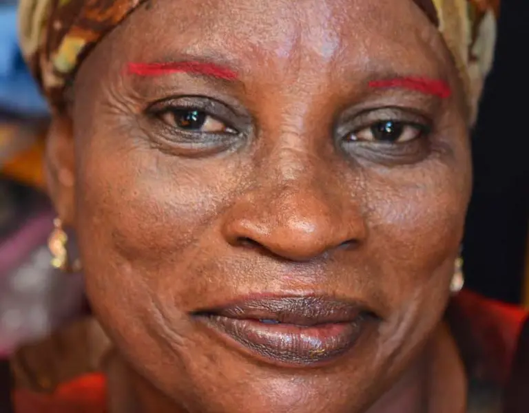 Skin Bleaching in Ghana Media and Cultural Impact Pulitzer Center