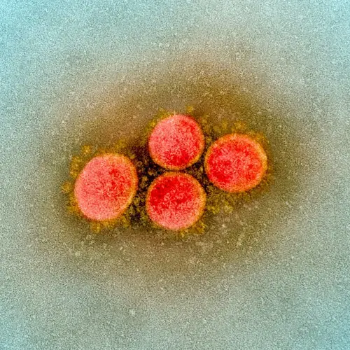A transmission electron microscope shows SARS-CoV-2, taken from a patient. Image courtesy of the National Institute of Allergy and Infectious Diseases/AFP. United States, 2020.