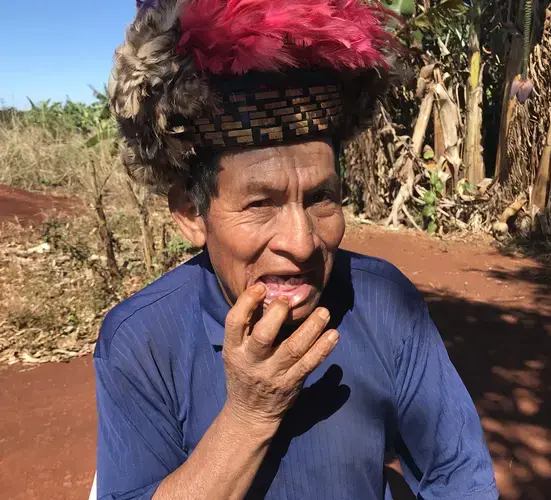 Cacique Ambrosio Ricardi (Guarani-Kaiowá) shows his broken jaw and teeth. Both are results of an assault to his settlement in the outskirts of Dourados, Mato Grosso do Sul. Image by Rafael Lima. Brazil, 2019.