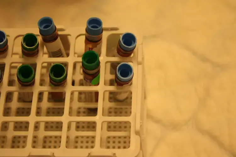 Vials with blood samples in DeCode's Genetics' lab in Reykjavik. Image by Anna M. Clausen. Iceland, 2017.