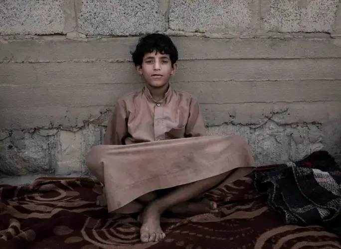 Morsal, a 14-year-old former child soldier, poses for a photograph at a camp for displaced persons where he took shelter in Marib, Yemen, in this July 27, 2018 photo. He said Houthi rebels took him from a soccer pitch where he was playing with his friends after school and forcibly enlisted him. He suffers from hearing loss from the sound of explosions and airstrikes. Many former child soldiers suffer from panic attacks and bouts of aggressive behavior from their trauma. Image by Nariman El-Mofty / AP News. Yemen, 2018.