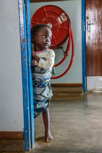 The majority of burn victims in Malawi are under the age of 5. Image by Nathalie Bertrams. Malawi, 2017.