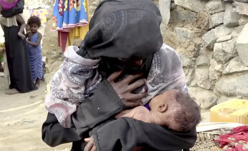 A severely malnourished infant Zahra breastfeeds from her mother, in Aslam, Hajjah. Image by Hammadi Issa/AP Photo. Yemen, 2018.