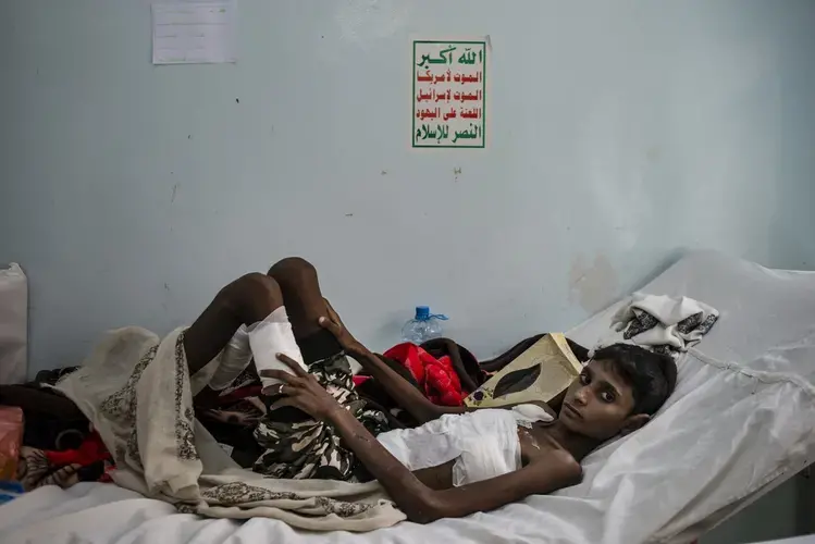 Hussein Hasan lays in bed on May 6, 2018, at Jumhuri Hospital in Hajjah, Yemen. Hussein sustained severe abdominal and chest trauma and spent 10 days in intensive care. Image by Alex Potter. Yemen, 2018.