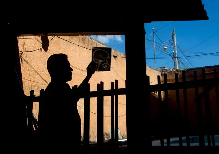 Jorge was extorted, kidnapped, beaten and left for dead after being deported back to Guerrero. He holds X-rays of the injuries he sustained in the beating. Image by Omar Ornelas/The Desert Sun. Mexico, 2019.