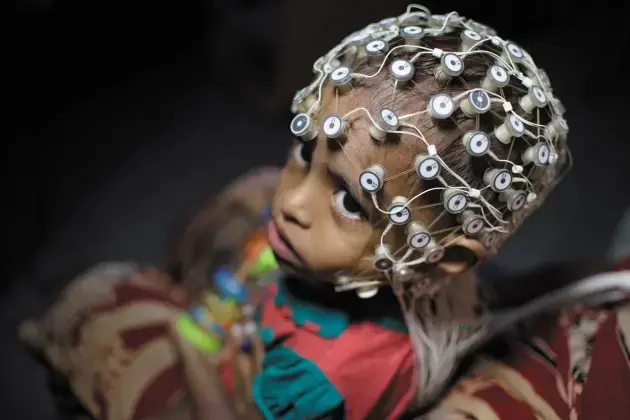 In Dhaka, a child undergoes electroencephalography to measure electrical brain activity. Image by Smita Sharma. Bangladesh.