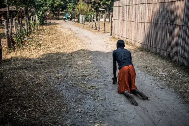 Fils Kunduku, 9, has paralysis in both legs. In Kahemba, many people with konzo crawl through the street because they cannot afford wheelchairs. Image by Neil Brandvold. DRC, 2017.