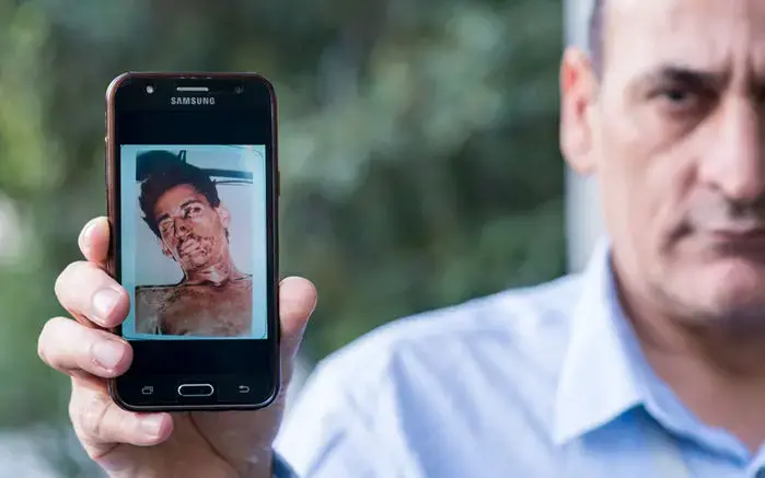 Ali Reza Yazdanpanah holds up a photo of himself after he was exposed to sulfur mustard during the Iran-Iraq War. Now a docent at the Tehran Peace Museum, he calls the repeated use of chemical weapons against his nation 'Iran's Hiroshima.' Image by Ebrahim Mirmalek. Iran.