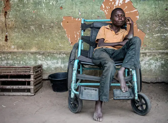 Etienne Tshiluanjim has konzo and survives on the brink of starvation. He and his family survive on the only food their neighbors donate to them — bitter cassava. Image by Neil Brandvold. DRC, 2017.