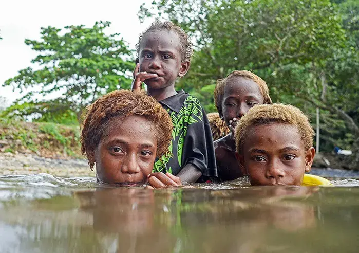 Children in Papua New Guinea are at high risk of yaws. The earlier eradication effort failed to treat kids with symptomless infections, who could later spread the disease. Image by Brian Cassey. Papua New Guinea, 2018.
