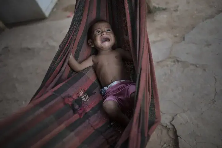 In this Nov. 25, 2019 file photo, Osmery Vargas, who is malnourished, cries in a hammock as she and her 7-year-old sister Yasmery Vargas wait for their mother to return from begging in the street for money and food in Maracaibo, Venezuela. Image by Rodrigo Abd/AP Photo. Venezuela, 2019.