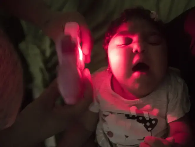 Fabiane Lopes, tries to calm her daughter Valentima by using a toy that makes music at their home Saturday, April 8, 2017 in Duque de Caxias, a suburb of Rio de Janeiro in southeastern Brazil. Valentima's mother was pregnant when she became infected with the Zika virus and her daughter was born with microcephaly— a congenital malformation with smaller than normal head size for age and sex as well as other profound birth defects. Brazil has confirmed far more malformations of the brain in babies born to mothers who were infected with Zika than any other country. After she gave birth to Valentina, she elected to have a tubal ligation so she could no become pregnant again. Image by Mark Hoffman. Brazil, 2017.