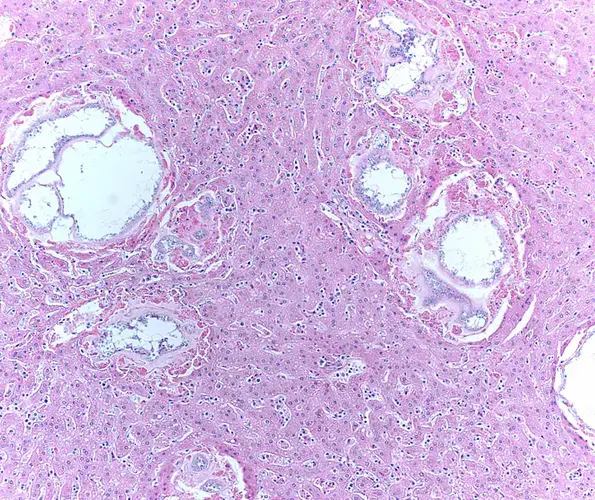 This 10x magnification image shows parasitic larval cysts of a tapeworm found on the liver of Mahal, the Milwaukee County Zoo's famous orangutan that died in 2012. The large and small white areas are the larval cysts. Image courtesy of Research Animal Resource Center, UW-Madison.<br />