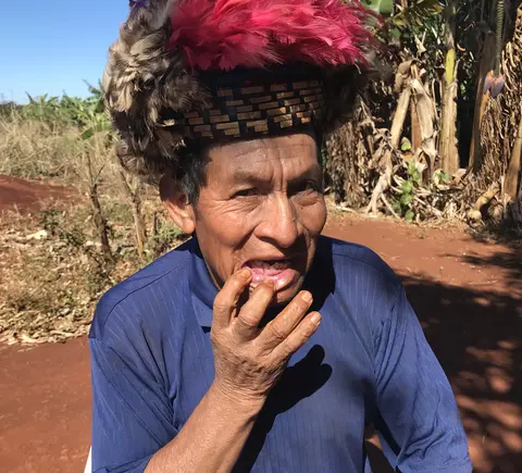 Cacique Ambrosio Ricardi (Guarani-Kaiowá) shows his broken jaw and teeth. Both are results of an assault to his settlement in the outskirts of Dourados, Mato Grosso do Sul. Image by Rafael Lima. Brazil, 2019.
