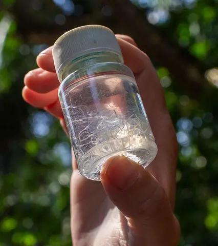 Someone holds up a small jar with roundworms and liquid in it.