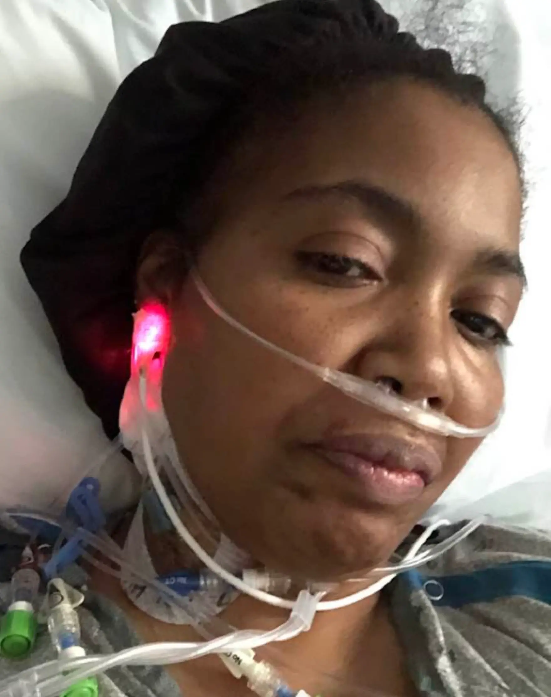 Woman has tubes around her neck as she wakes up from surgery