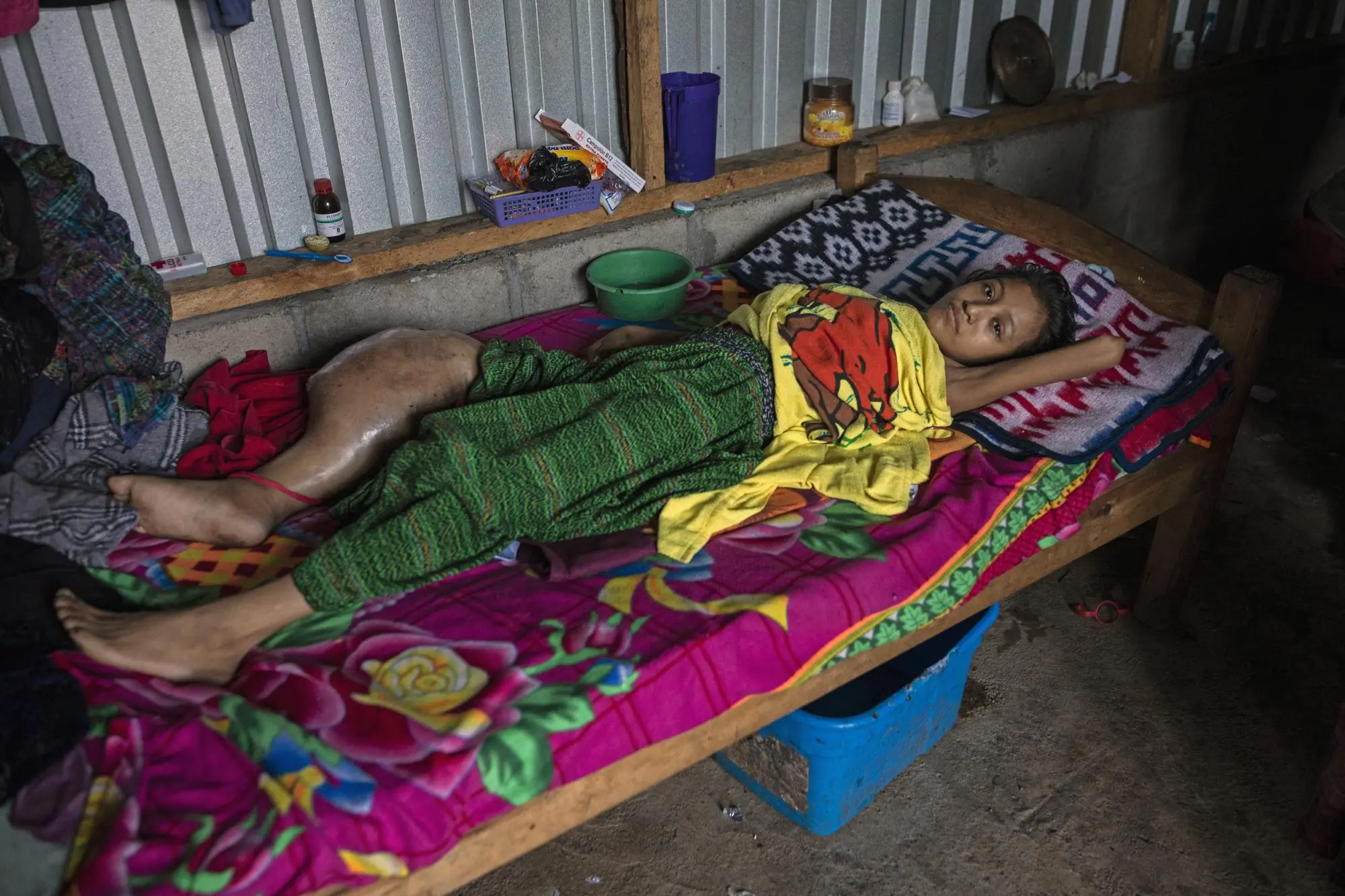 A young girl lays on a bed