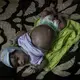 Nine-month-old Bushra lies on a bed, belly bloated from electrolyte imbalance and malnutrition. Image by Alex Potter. Yemen, 2018. 